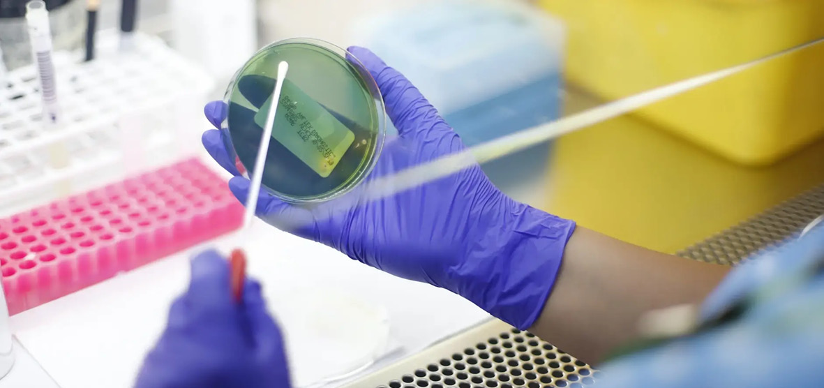 Telerik.Sitefinity.Frontend.Mvc.Models.DynamicDataItemFieldAccessor. ImagenPrincipal.Fields.AlternativeText