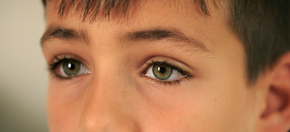 conjuntivitis conjuntivitis