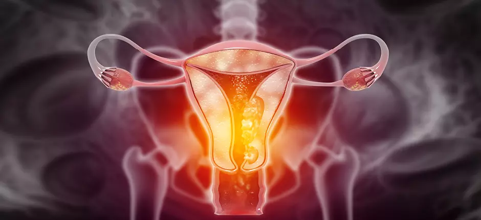cancer cervico uterino clinica uandes