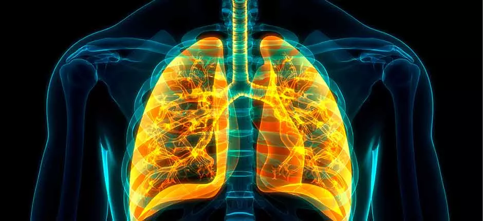 Fibrosis pulmonar