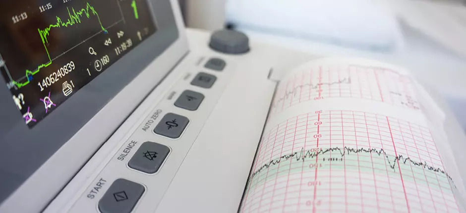 electrocardiograma