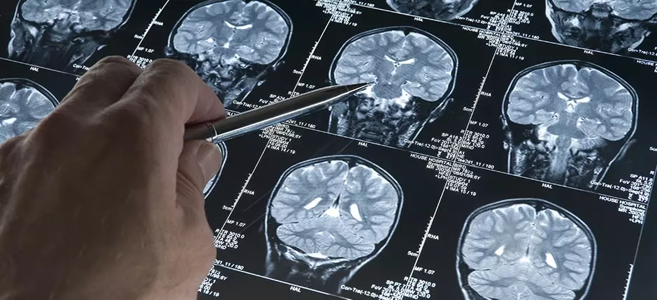 Novedad_desarrollan tumores cerebrales_940x430-min