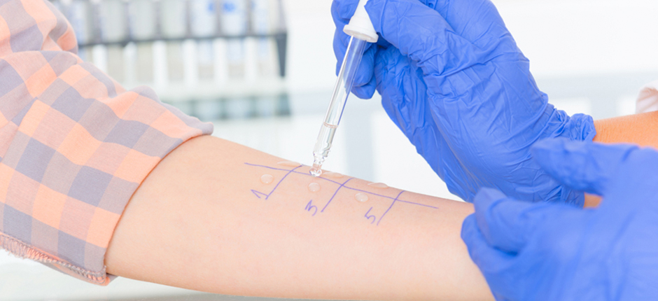 prick-test-a-que-le-tengo-alergia prick-test-a-que-le-tengo-alergia